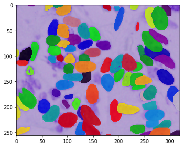 _images/DSBowl18_segmentation_5_0.png