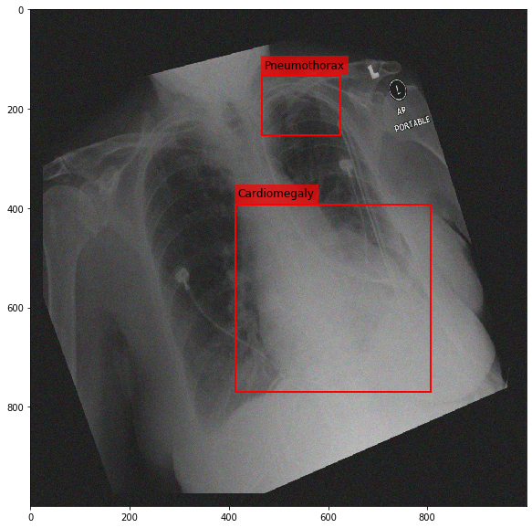 _images/Medical_Data_Augmentation_CXR14_22_0.png