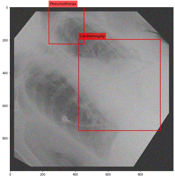 _images/Medical_Data_Augmentation_CXR14_22_4.png