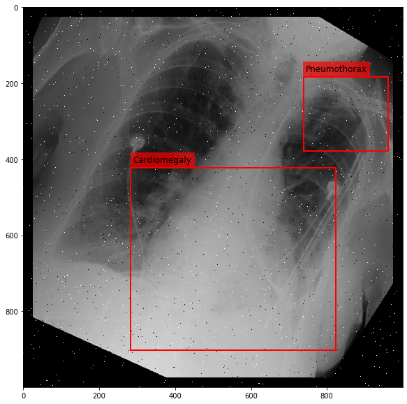 _images/Medical_Data_Augmentation_CXR14_22_5.png