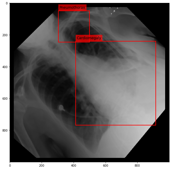 _images/Medical_Data_Augmentation_CXR14_22_9.png